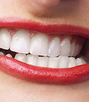 Äiti voi suojata lapsen hampaita yksinkertaisella keinolla: syömällä ksylitolipurkkaa 
